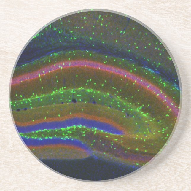 Interneuron 6 coaster (Front)