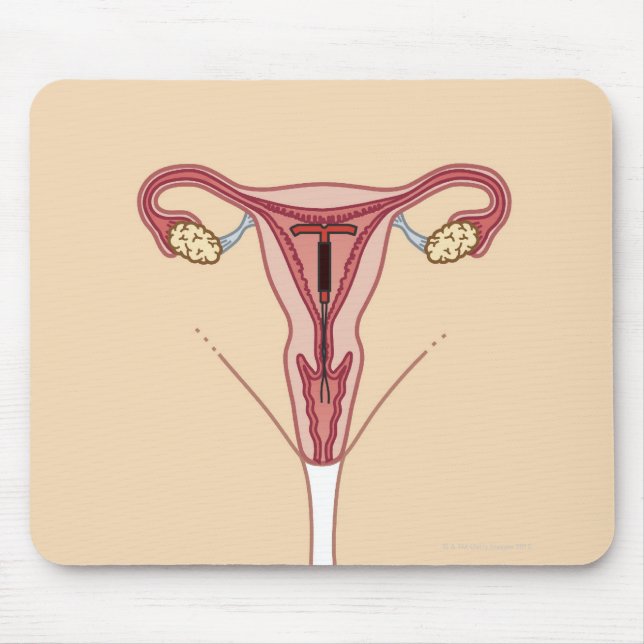 Intrauterine Device Mouse Mat (Front)