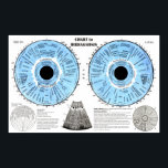 Iridiagnosis Iridology Eye Chart<br><div class="desc">Iridiagnosis Iridology Eye Chart. The chart shows the organ relationships within the iris, the seven zones of the iris, section of the iris, the densities of the iris and common signs found during acute and chronic changes. Iridology: Diagnostic system that states that every bodily organ corresponds to a location on...</div>