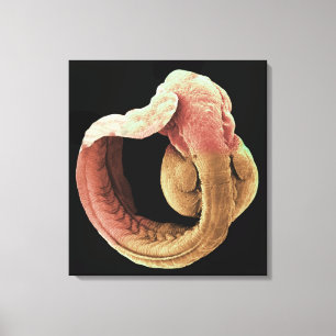 Japanese Medaka Fish embryo Canvas Print