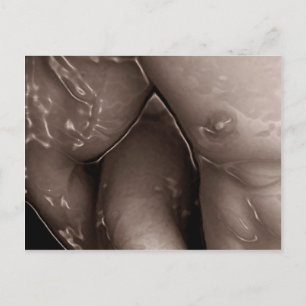 Jelled Embrace Postcard