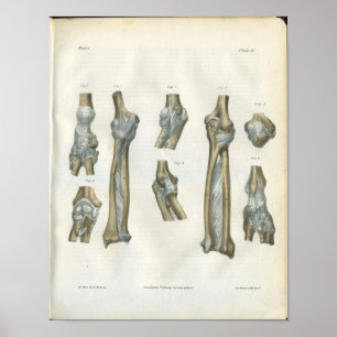 Joints of the Elbow & Arm Anatomy Print