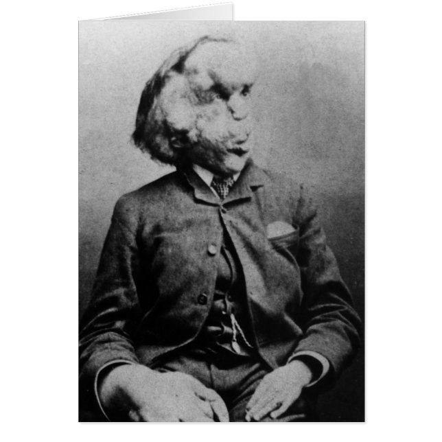 Joseph "John" Merrick The Elephant Man from 1889 (Front)