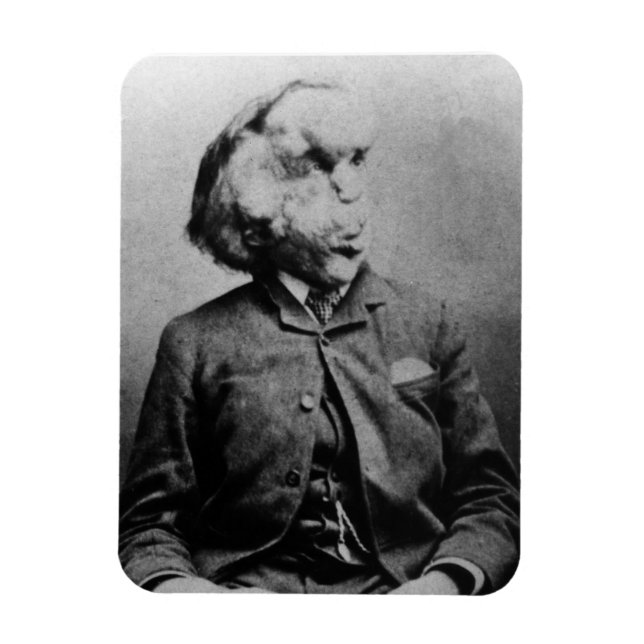 Joseph "John" Merrick The Elephant Man from 1889 Magnet (Vertical)
