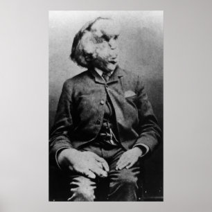 Joseph "John" Merrick The Elephant Man from 1889 Poster