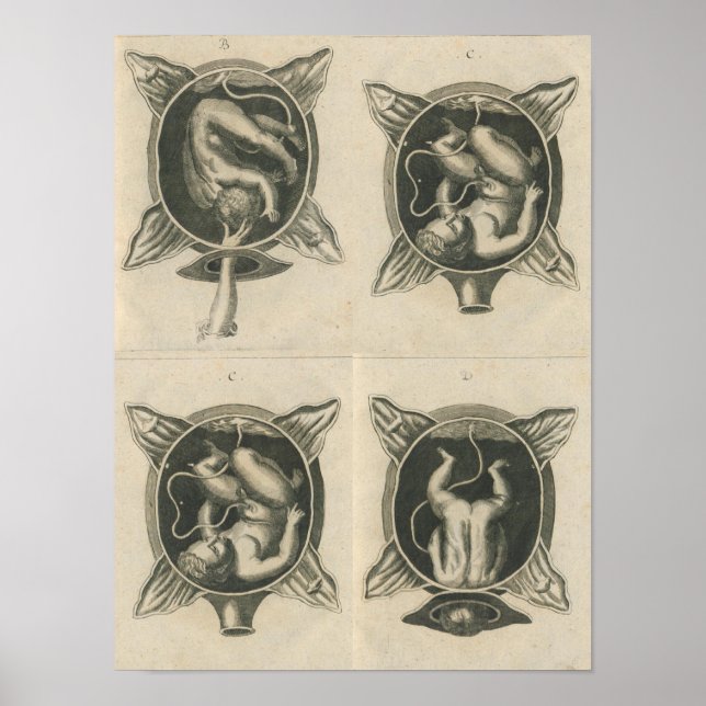 Justine Siegemund Court Midwife Baby Birth Deliver Poster (Front)