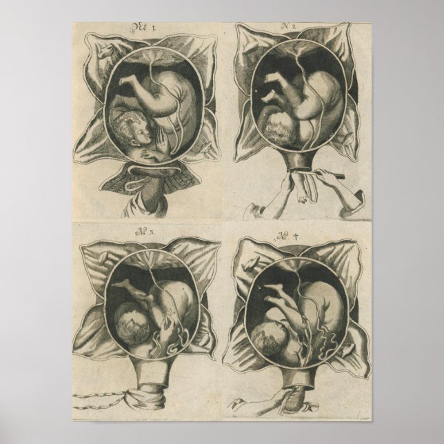 Justine Siegemund Court Midwife Birth Pregnancy Poster (Front)