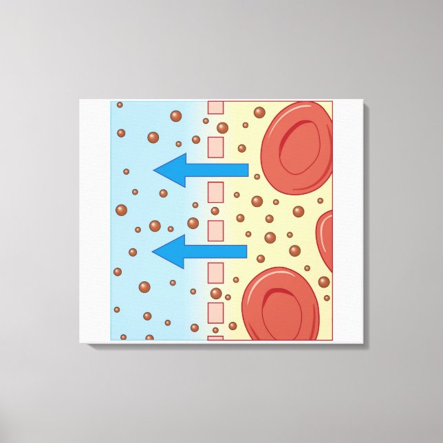 Kidney Dialysis Canvas Print (Front)