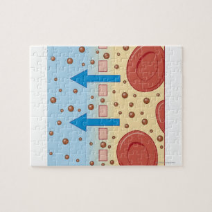 Kidney Dialysis Jigsaw Puzzle