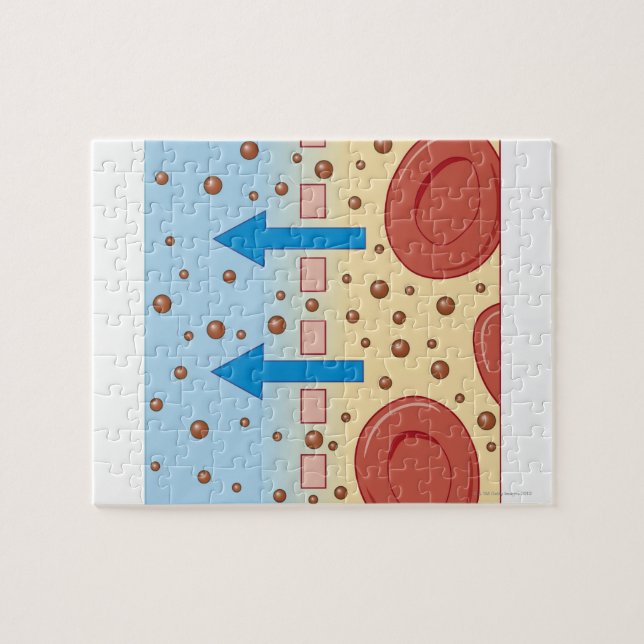 Kidney Dialysis Jigsaw Puzzle (Horizontal)