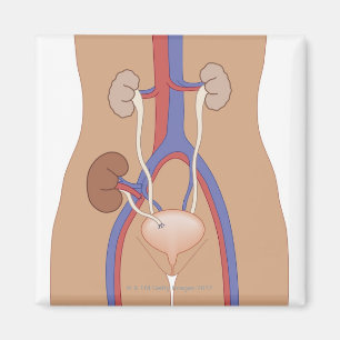 Kidney Transplant Magnet