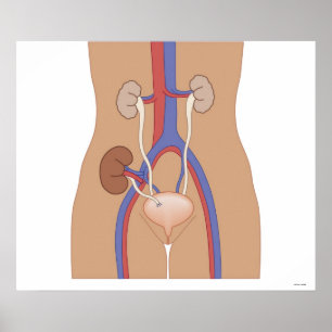 Kidney Transplant Poster