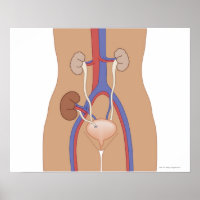 Kidney Transplant