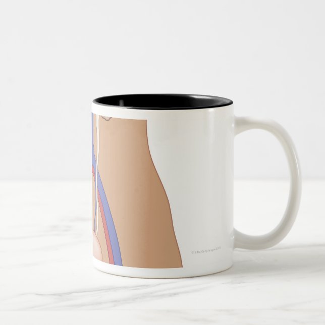 Kidney Transplant Two-Tone Coffee Mug (Right)