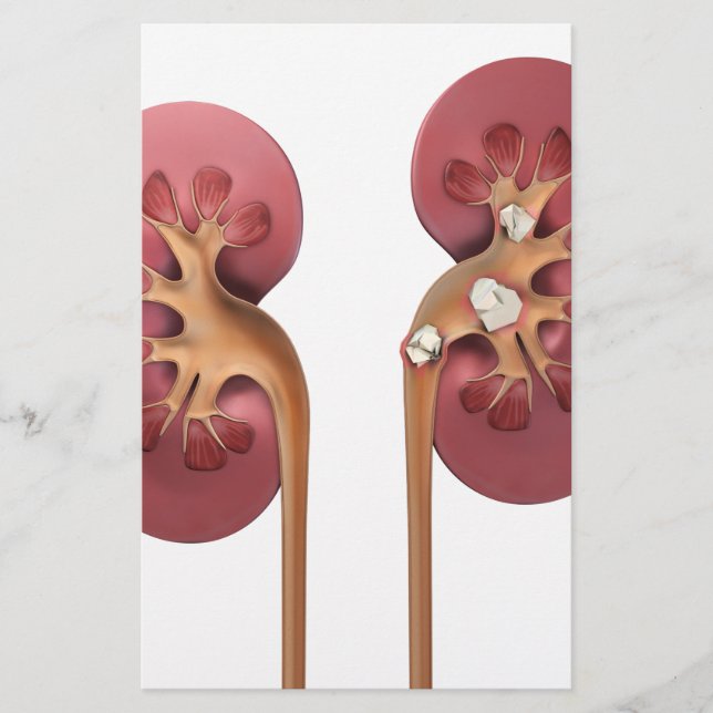 kidneys (Front)