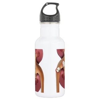 kidneys 532 ml water bottle