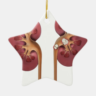 kidneys ceramic tree decoration