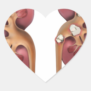 kidneys heart sticker