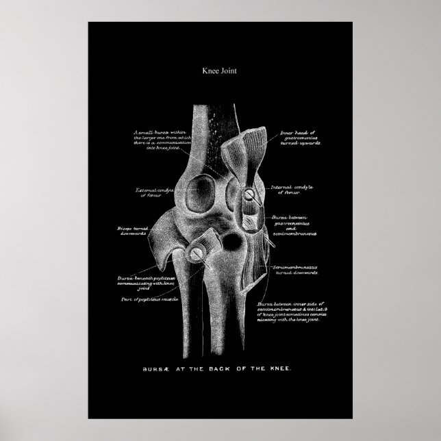 Knee Joint Anatomy Medical Wall Decor (Front)