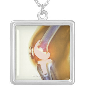 Knee replacement. Coloured X-ray of a total knee Silver Plated Necklace