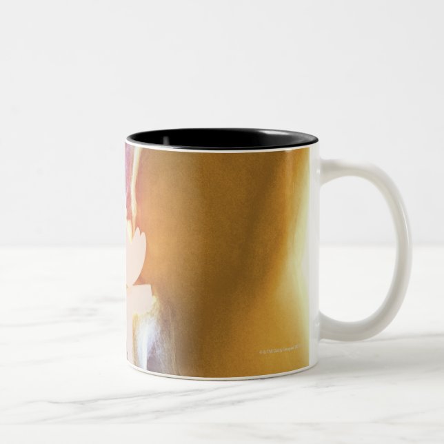 Knee replacement. Coloured X-ray of a total knee Two-Tone Coffee Mug (Right)