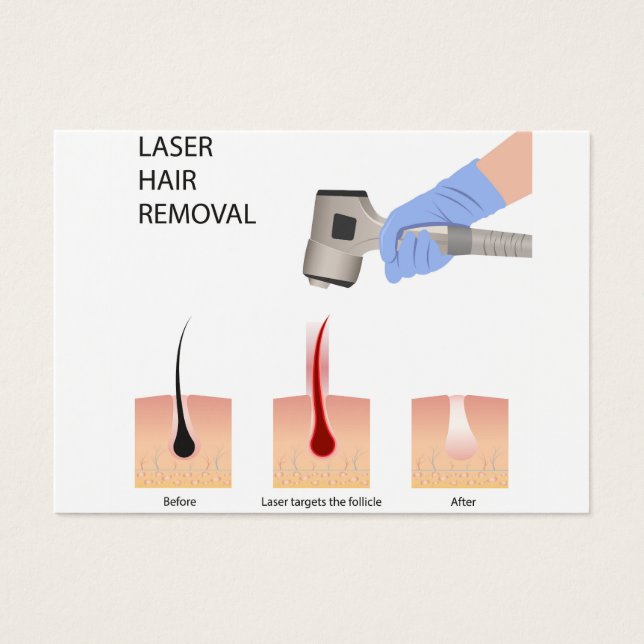 Laser hair removal  (Front)