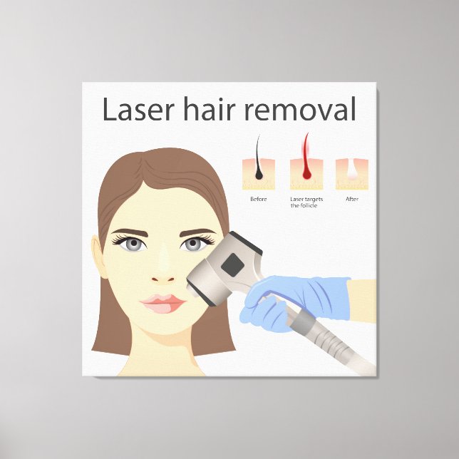 Laser hair removal structure canvas print (Front)