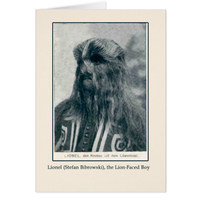 Lionel, the Lion Faced Boy Cards and Postcards (Front)