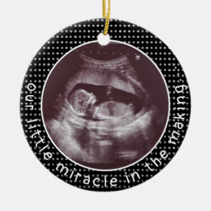 Little Miracle In Making Ultrasound Sonogram Ceramic Tree Decoration