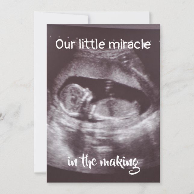 Little Miracle Ultrasound 2 Photo Baby Family Announcement (Front)