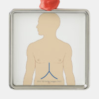 Liver Transplant