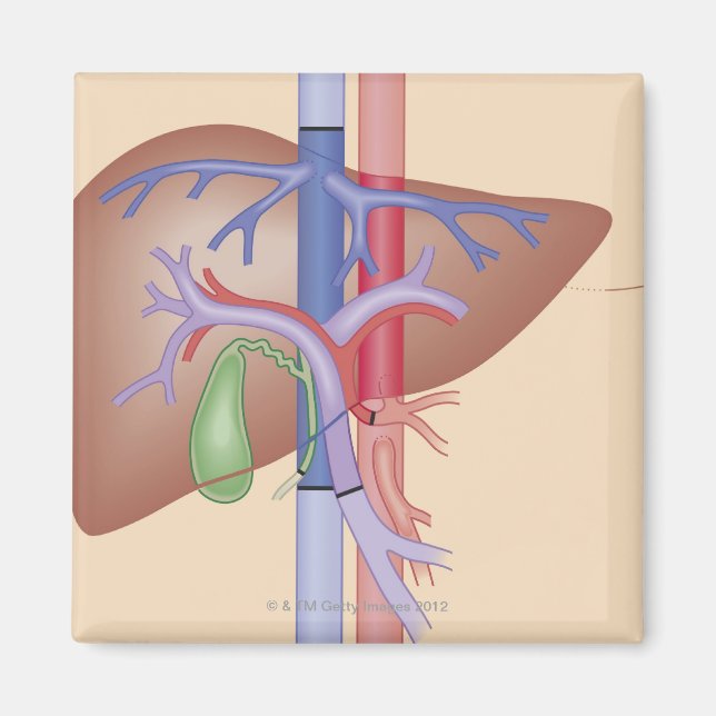 Liver Transplant Procedure Magnet (Front)
