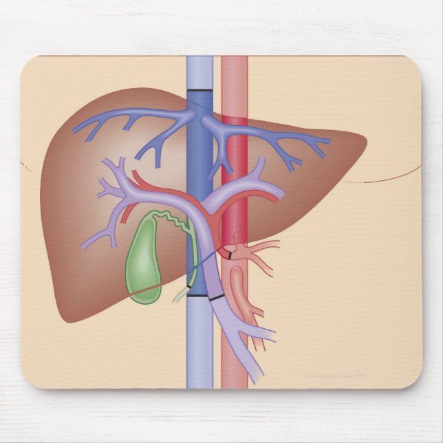 Liver Transplant Procedure Mouse Mat (Front)
