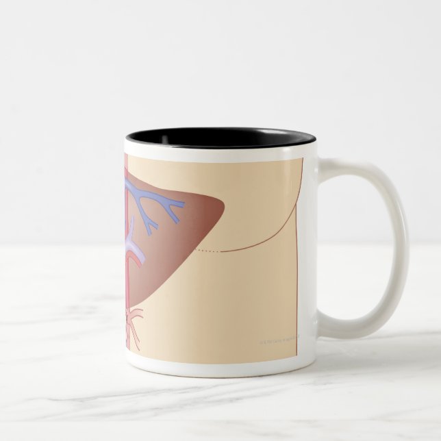 Liver Transplant Procedure Two-Tone Coffee Mug (Right)