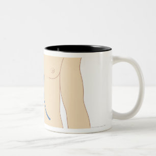 Liver Transplant Two-Tone Coffee Mug