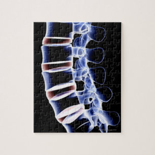 Lumbar Vertebrae 2 Jigsaw Puzzle