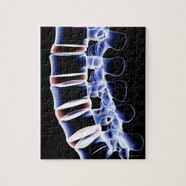 Lumbar Vertebrae 2 Jigsaw Puzzle (Vertical)