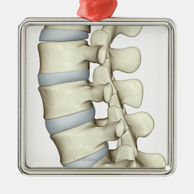Lumbar Vertebrae Metal Tree Decoration (Front)