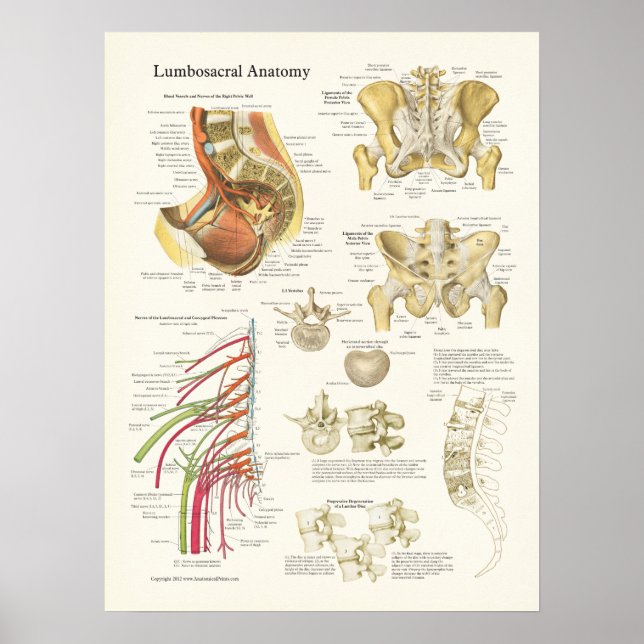 Lumbosacral Anatomy Poster and Spine Degeneration (Front)