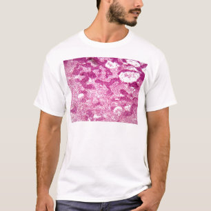 Lymph node cells under the microscope. T-Shirt