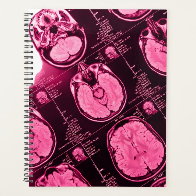 Magenta MRI: An Axial View of the Brain Planner (Front)