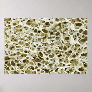 Magnified Porous Texture from the Human Hip Bone Poster