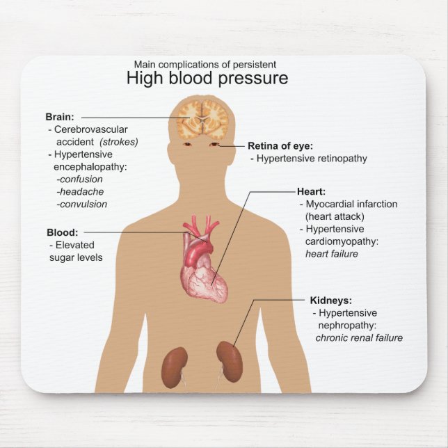 Main Complications of High Blood Pressure Chart Mouse Mat (Front)
