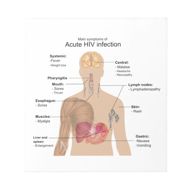 Main Symptoms of Acute HIV Infection Notepad (Front)