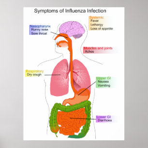 Main Symptoms of an Influenza Infection Diagram Poster