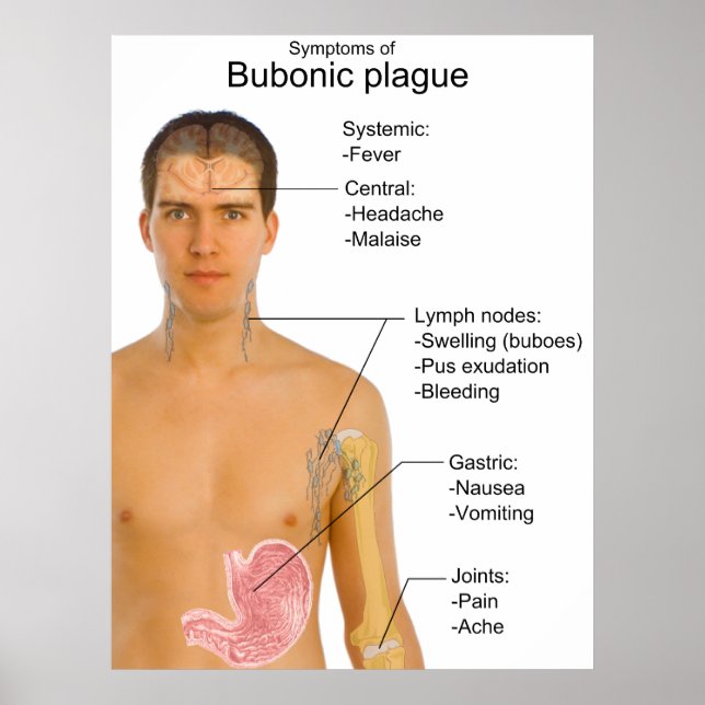 Main Symptoms of Black Death Bubonic Plague Chart (Front)