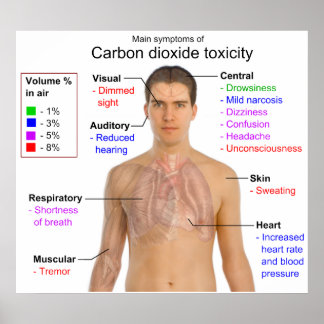 Main Symptoms of Carbon Dioxide Toxicity Chart