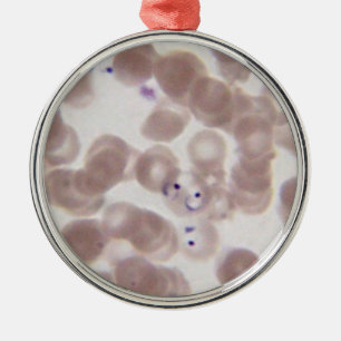 Malaria (Plasmodium) blood smear Metal Tree Decoration