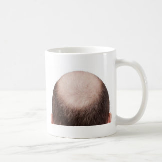 Male Pattern Baldness Coffee Mug