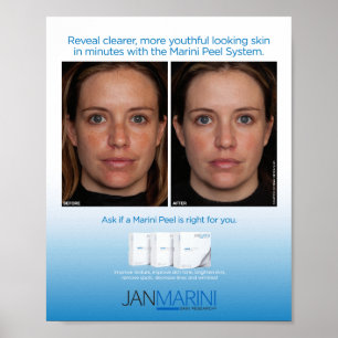 Marini Peel System 8x10" Poster